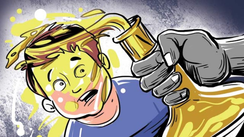 आफ्नै छोरामाथि एसिड अट्याक : बाबु पक्राउ