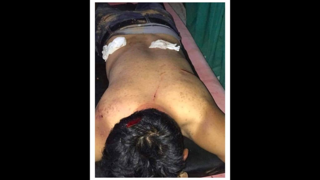 स्याङ्जामा एमाले र काँग्रेस कार्यकर्ताबीच खुकुरी हानाहान : एक घाईते