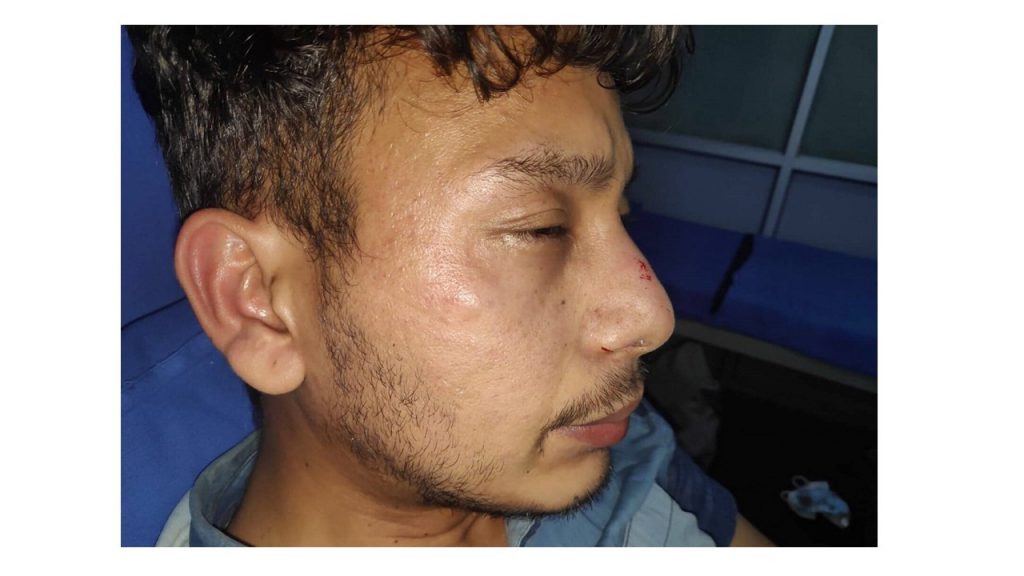 पैदल हिँडिरहेका डाक्टरमाथि कुटपिट गर्ने ट्राफिक प्रहरी निलम्बनमा