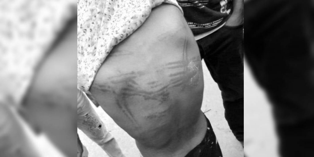 स्कुल नआएको भन्दै शिक्षकले घरमै गएर बालिका कुटे