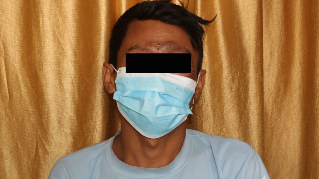 कास्कीको मादीका दुर्गालाई पेट्रोल छर्केर आगो लगाई फरार युुवक पक्राउ