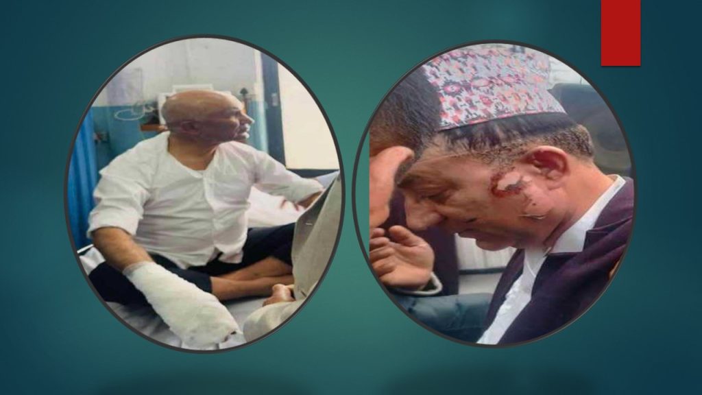 अर्थमन्त्री पौडेल र मेयर आचार्यलाई थप उपचारका लागि काठमाडौं लगियो