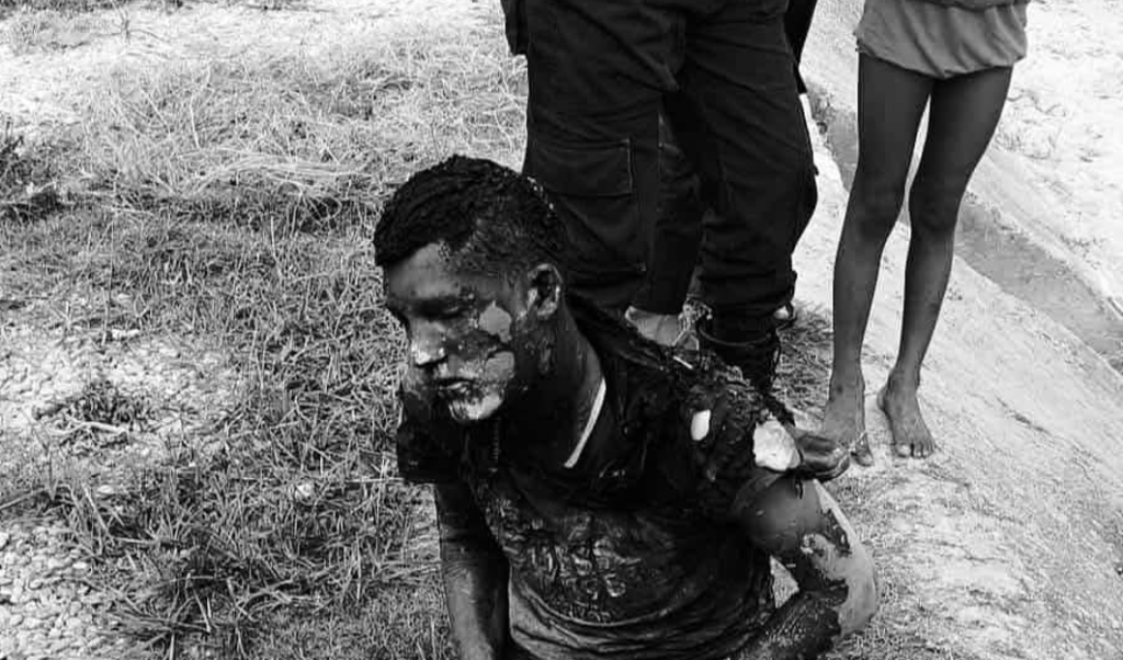 सुटकेसभित्र मृत भेटिएकी रुबी साहको हत्याका आरोपी लक्ष्मण पासवान जलेको अवस्थामा पक्राउ