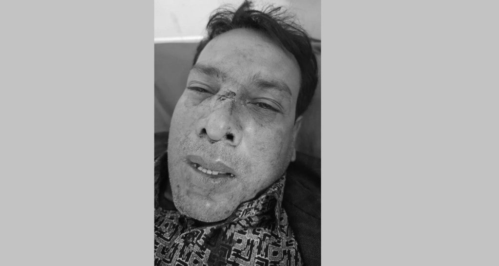 आजपाका समानुपातिक उम्मेदवार मन्सुरीमाथि घरदैलोको क्रममा आक्रमण